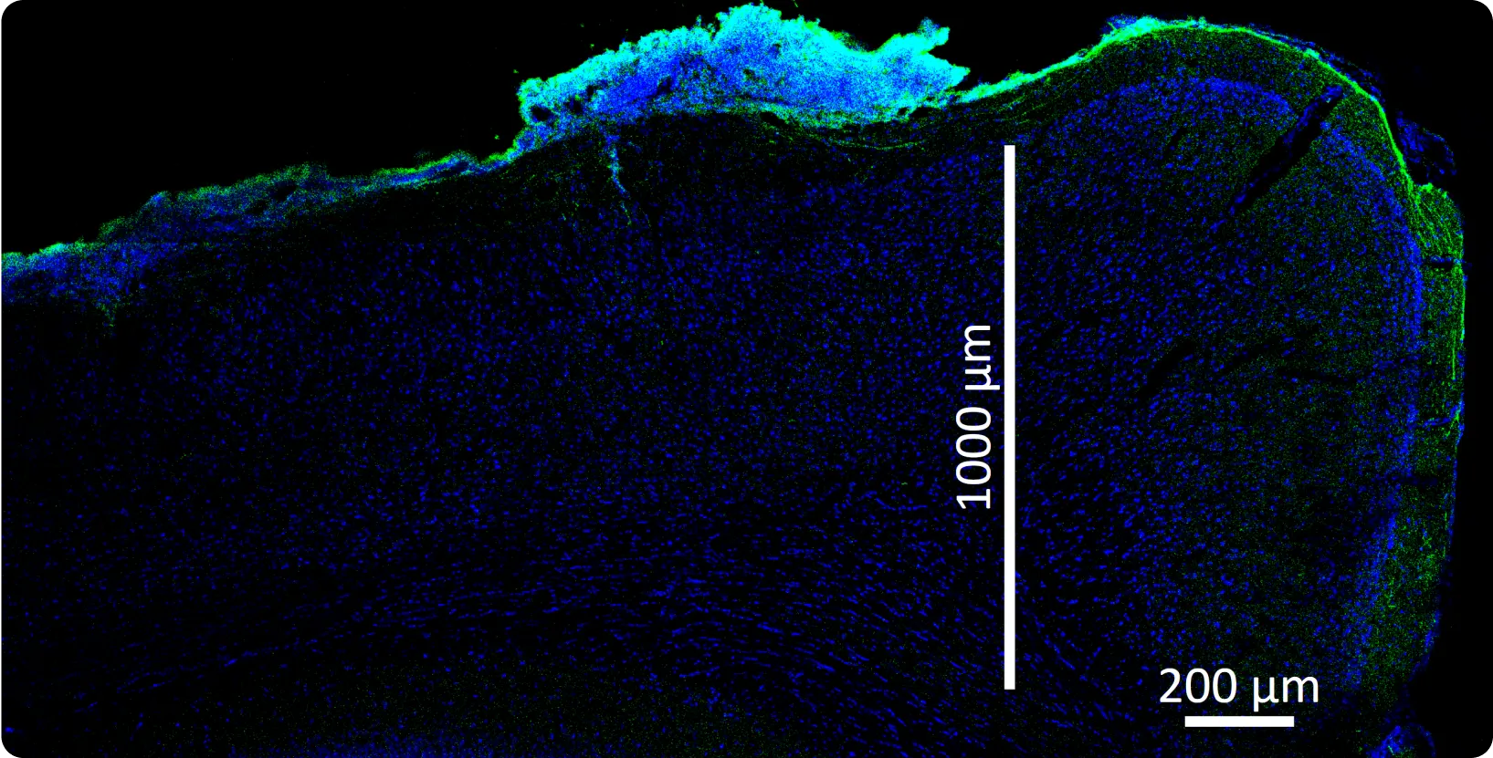 A microscope image of a sample of brain tissue showing biohybrid neurons forming a long axon bundle that extends around the right side of the brain.