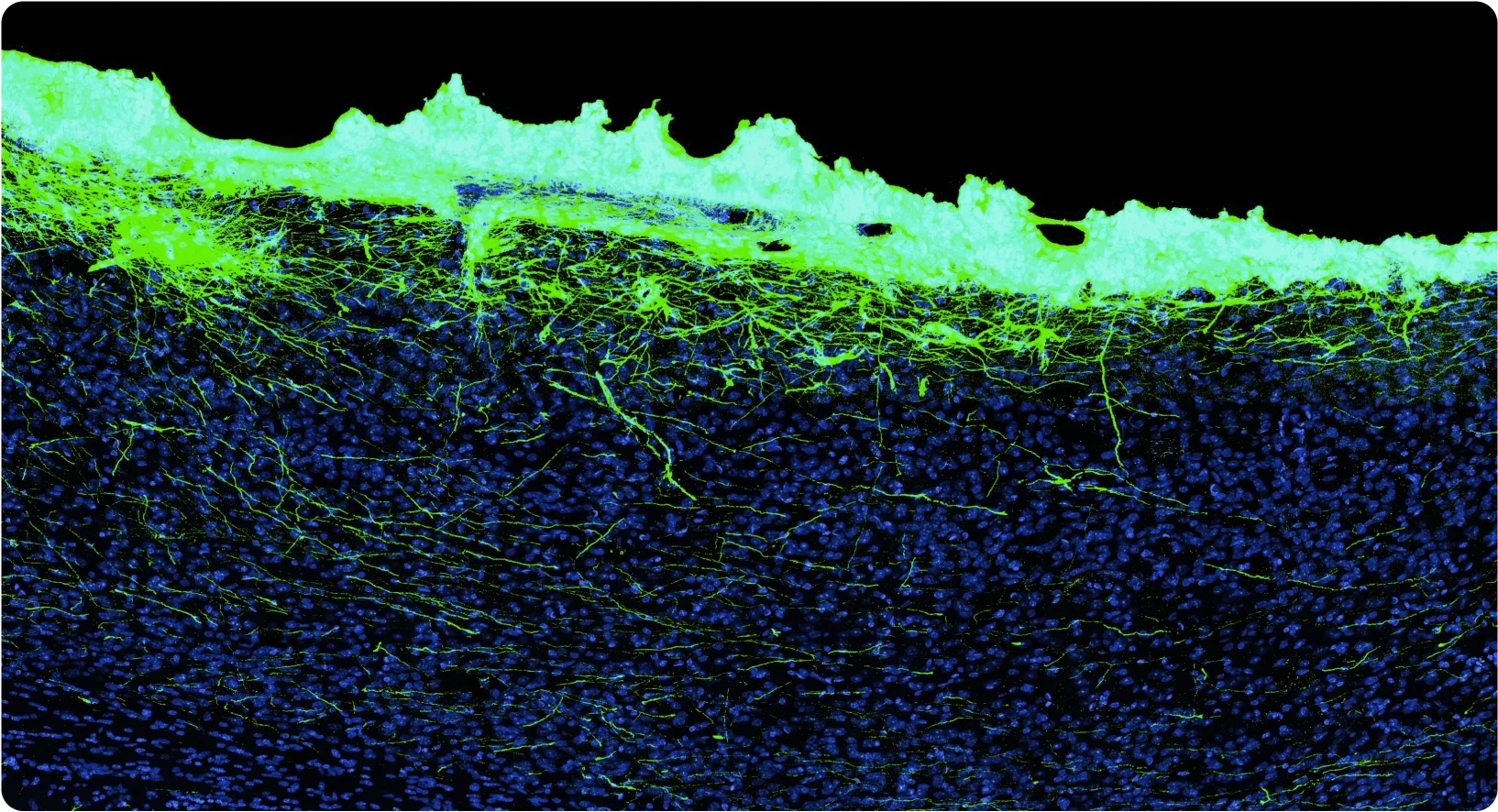 A microscope image of a sample of brain tissue showing biohybrid neurons engrafted into the brain.