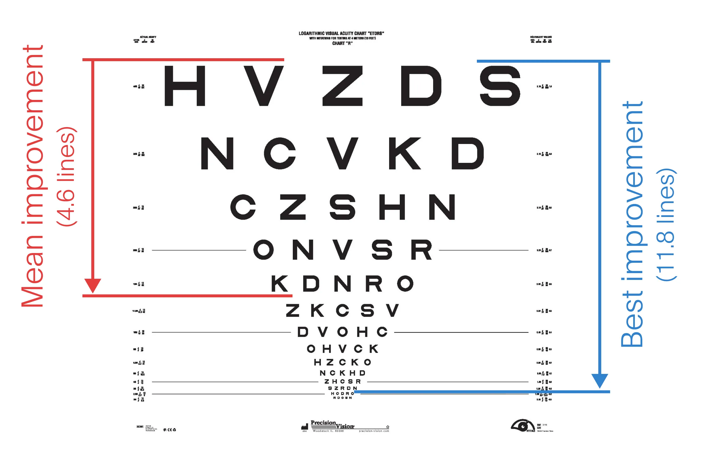 An ETDRS chart is shown with markups noting the average improvement (23 letters) and the best improvement (59 letters) exhibited by subjects.