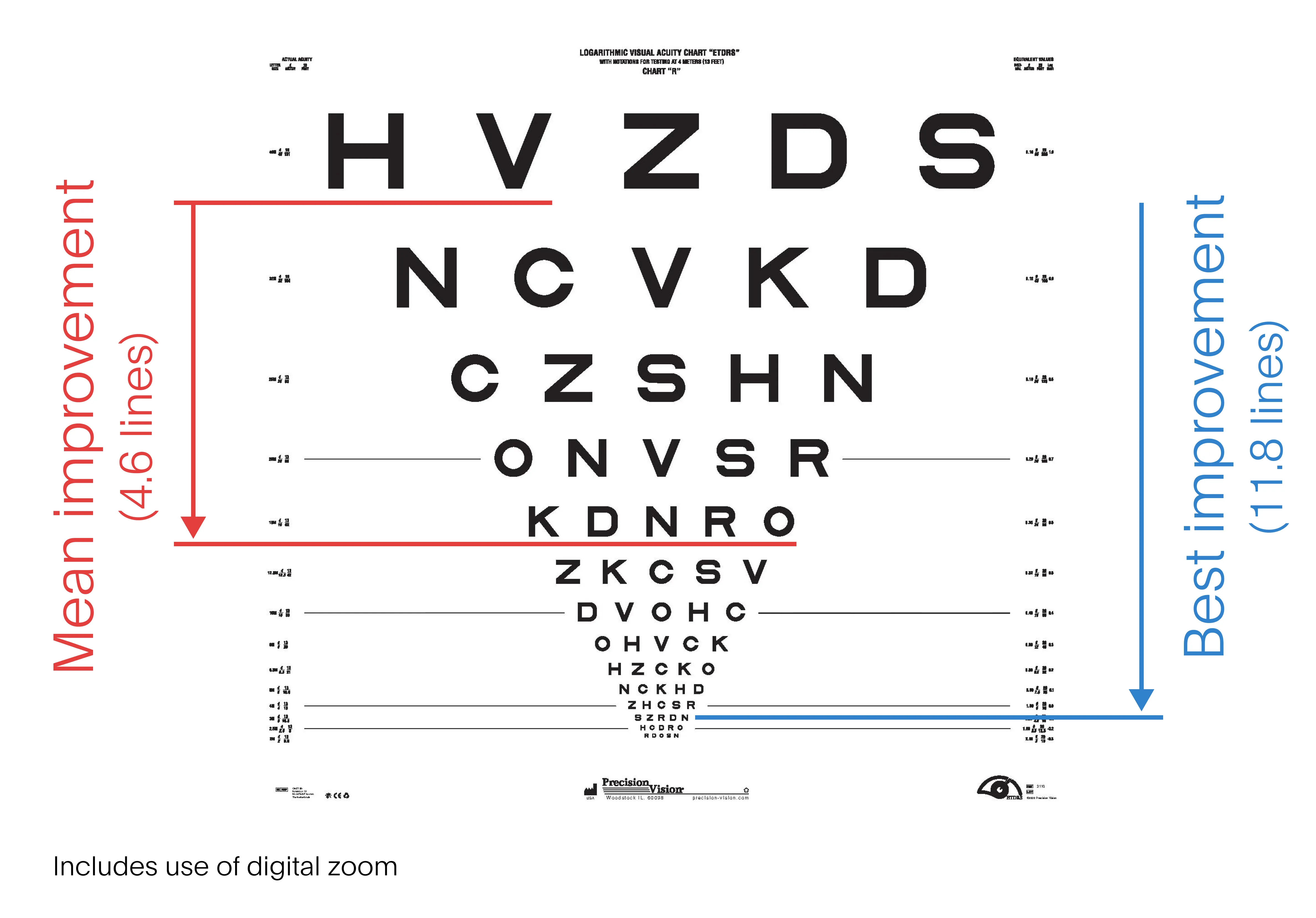 An ETDRS chart is shown with markups noting the average improvement (23 letters) and the best improvement (59 letters) exhibited by subjects.