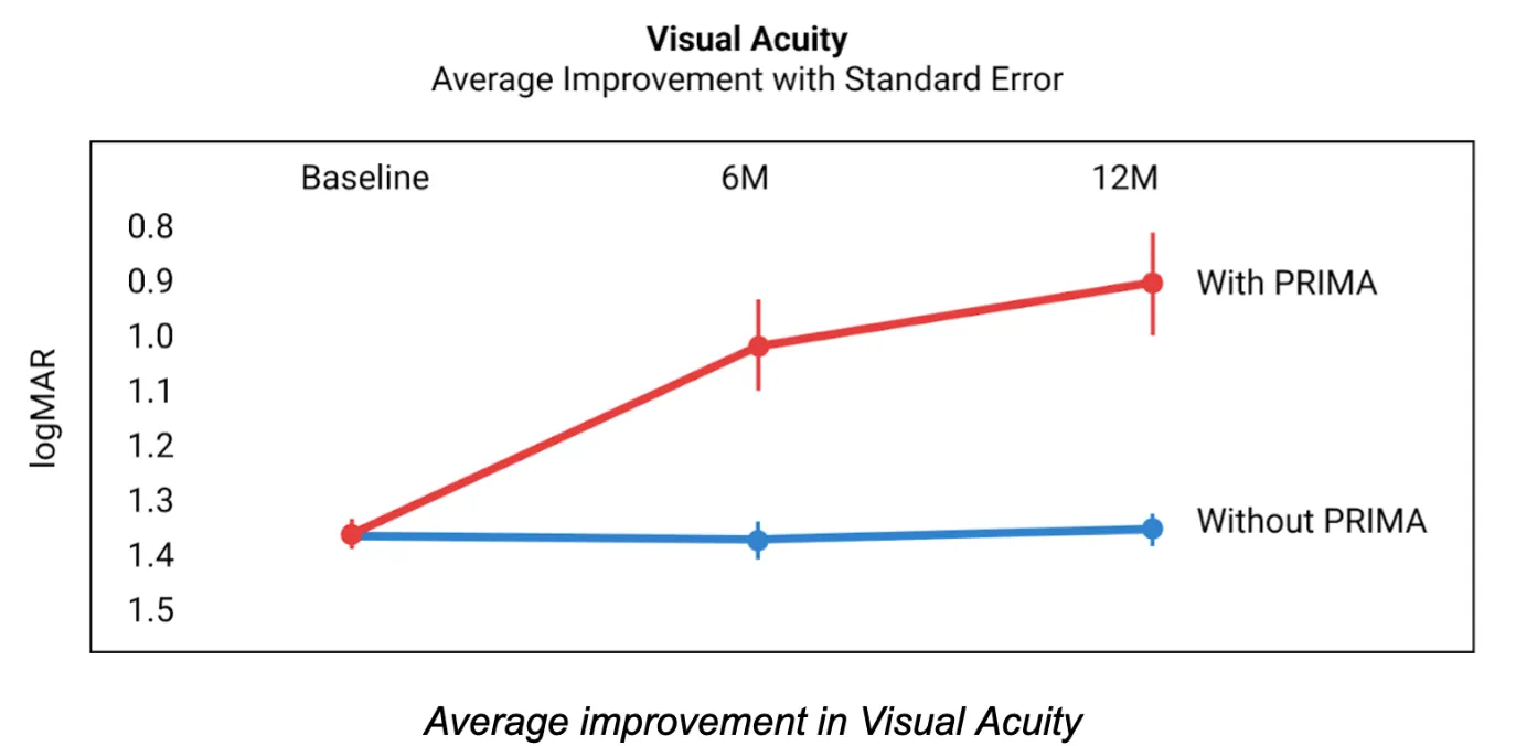 A chart shows the change in visual acuity when a subject was and was not using the PRIMA implant. Average visual acuity while using the PRIMA implant improved from ~1.3 to ~0.9 while the average visual acuity without using the implant remained constant at ~1.3.