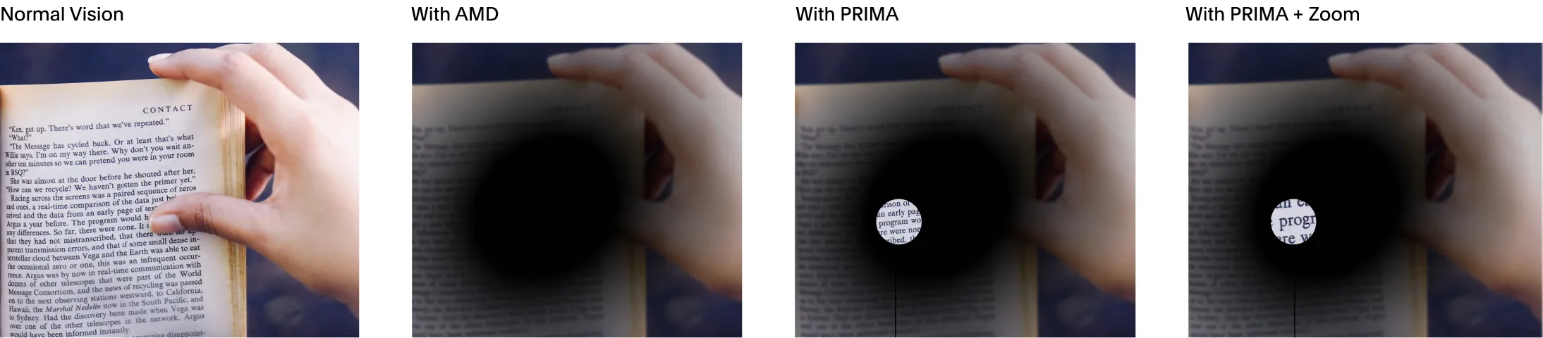 A repeated image of book text displays the difference between normal vision, vision affected by AMD, vision when using PRIMA, and vision when using PRIMA and its zoom function.