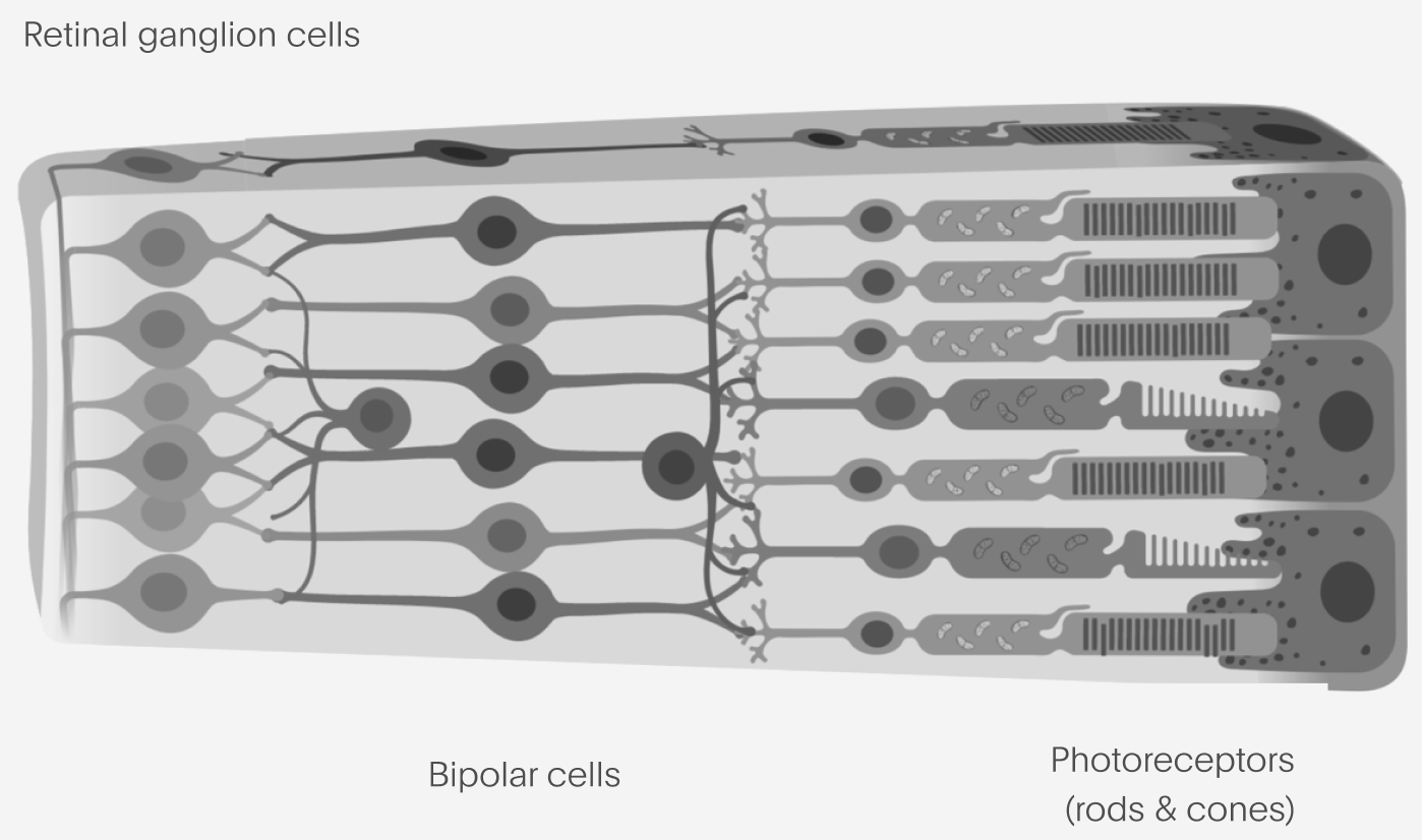 An illustration of the anatomy of a healthy retina, starting with the retinal ganglion cells, then bipolar cells, and finally photoreceptors (rods & cones).