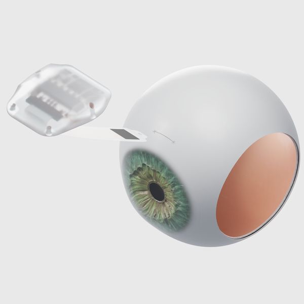A render of the Science Eye unfolded against the outside of an eyeball