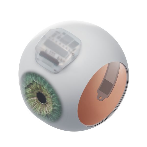 A render of the electronics package of the Science Eye on the outside of an eyeball, for size comparison