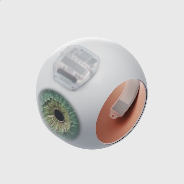 A render of the Science Eye inserted into an eyeball
