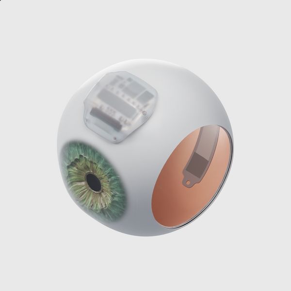 A render of the Science Eye inserted and secured against the inside of an eyeball